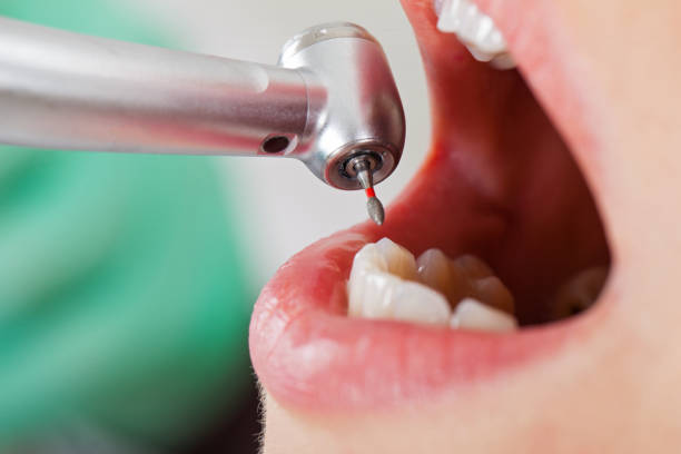 Best Chipped Tooth Repair Near Me  in Hazel Park, MI
